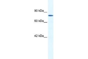 WB Suggested Anti-ZNF214 Antibody Titration:  1. (ZNF214 anticorps  (N-Term))