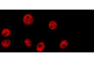 ABIN6269297 staining HepG2 by IF/ICC. (Histone H3.1 anticorps)
