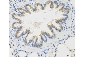 Immunohistochemistry of paraffin-embedded Rat lung using TICAM1 Polyclonal Antibody at dilution of 1:100 (40x lens). (TICAM1 anticorps)