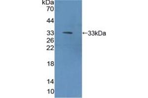 Western blot analysis of recombinant Mouse METRN. (METRN anticorps  (AA 22-291))