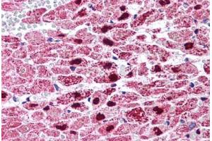 Human Heart (formalin-fixed, paraffin-embedded) stained with PPARG antibody ABIN214562 at 5 ug/ml followed by biotinylated goat anti-rabbit IgG secondary antibody ABIN481713, alkaline phosphatase-streptavidin and chromogen. (PPARG anticorps  (Internal Region))