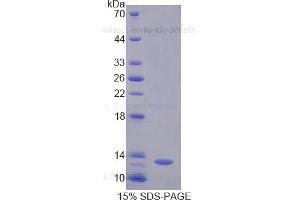 SDS-PAGE of Protein Standard from the Kit (Highly purified E.