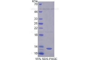 SDS-PAGE of Protein Standard from the Kit (Highly purified E. (DAO Kit ELISA)