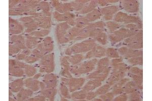 IHC image of ABIN7165048 diluted at 1:100 and staining in paraffin-embedded human heart tissue performed on a Leica BondTM system.