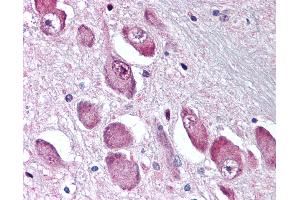 Anti-GABRA3 antibody IHC of human brain, basal nucleus of Meynert.