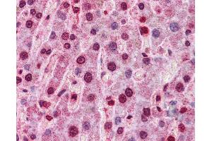 Immunohistochemistry (IHC) image for anti-Hepatocyte Nuclear Factor 4, alpha (HNF4A) (Middle Region) antibody (ABIN2779763)