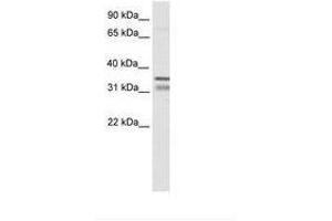 Image no. 1 for anti-NK2 Homeobox 2 (Nkx2-2) (AA 30-79) antibody (ABIN6736071) (Nkx2-2 anticorps  (AA 30-79))