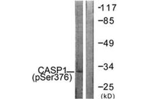 Western blot analysis of extracts from 293 cells, using Caspase 1 (Phospho-Ser376) Antibody. (Caspase 1 anticorps  (pSer376))