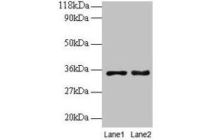 Western blot All lanes: PTDSS1 antibody at 2 μg/mL Lane 1: EC109 whole cell lysate Lane 2: 293T whole cell lysate Secondary Goat polyclonal to rabbit IgG at 1/15000 dilution Predicted band size: 56, 39, 35 kDa Observed band size: 35 kDa (PTDSS1 anticorps  (AA 1-35))