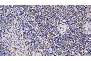Detection of IL17RA in Human Spleen Tissue using Polyclonal Antibody to Interleukin 17 Receptor A (IL17RA) (IL17RA anticorps  (AA 33-172))