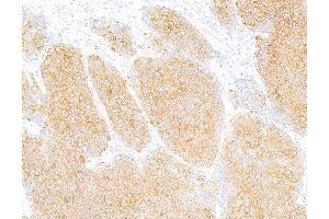 Immunohistochemistry (IHC) image for anti-Tubulin, beta (TUBB) (AA 1-50) antibody (ABIN7453995) (Recombinant TUBB anticorps  (AA 1-50))