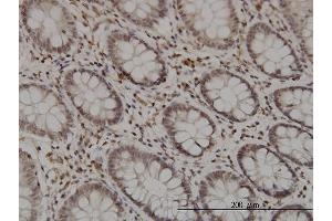 Immunoperoxidase of monoclonal antibody to GMEB1 on formalin-fixed paraffin-embedded human colon.