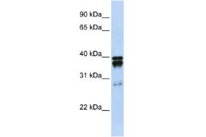 WB Suggested Anti-NUDT18 Antibody Titration:  0. (NUDT18 anticorps  (N-Term))