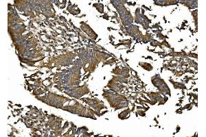 IHC analysis of MitoNEET/CISD1 using anti-MitoNEET/CISD1 antibody (ABIN7601089).