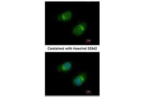 ICC/IF Image Immunofluorescence analysis of methanol-fixed HeLa, using COL3A1, antibody at 1:50 dilution. (COL3A1 anticorps  (C-Term))
