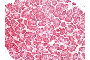 Human, Pancreas: Formalin-Fixed Paraffin-Embedded (FFPE)