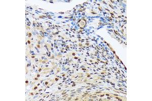Immunohistochemistry of paraffin-embedded rat ovary using HES5 Rabbit mAb (ABIN7267559) at dilution of 1:100 (40x lens). (HES5 anticorps)