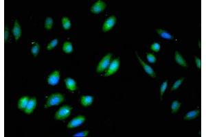 Immunofluorescent analysis of A549 cells using ABIN7145784 at dilution of 1:100 and Alexa Fluor 488-congugated AffiniPure Goat Anti-Rabbit IgG(H+L) (BIN3 anticorps  (AA 8-240))