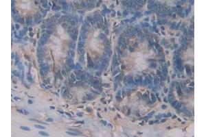 DAB staining on IHC-P; Samples: Rat Small intestine Tissue (CD42a anticorps  (AA 1-161))