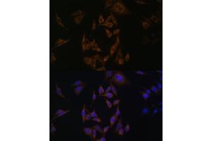 Immunofluorescence analysis of HeLa cells using UBE2L6 antibody (ABIN6134446, ABIN6149808, ABIN6149809 and ABIN6217753) at dilution of 1:100.