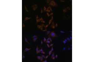 Immunofluorescence analysis of HeLa cells using UBE2L6 antibody (ABIN6134446, ABIN6149808, ABIN6149809 and ABIN6217753) at dilution of 1:100. (UBE2L6 anticorps  (C-Term))