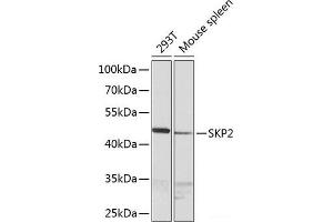 Western blot analysis of extracts of various cell lines using SKP2 Polyclonal Antibody at dilution of 1:1000. (SKP2 anticorps)