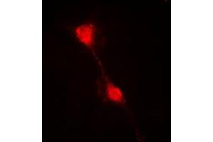 Immunofluorescent analysis of IKB alpha staining in HepG2 cells. (NFKBIA anticorps  (N-Term))