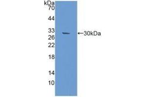 Detection of Recombinant RAD50, Mouse using Polyclonal Antibody to DNA Repair Protein RAD50 (RAD50) (RAD50 anticorps  (AA 1-234))