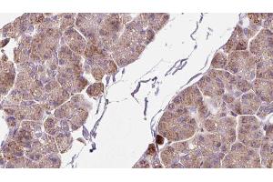 anti-DEXH (Asp-Glu-X-His) Box Polypeptide 58 (DHX58) (Internal Region) antibody