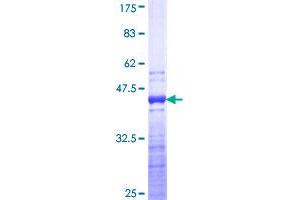 Image no. 1 for Fast Skeletal Troponin T (TNNT3) (AA 161-258) protein (GST tag) (ABIN1323292)