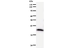 Western Blotting (WB) image for anti-DEAD (Asp-Glu-Ala-Asp) Box Polypeptide 5 (DDX5) antibody (ABIN933122) (DDX5 anticorps)
