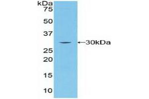 Detection of Recombinant BRCA2, Human using Polyclonal Antibody to Breast Cancer Susceptibility Protein 2 (BRCA2)