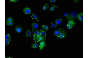 Immunofluorescent analysis of MCF-7 cells using ABIN7149653 at dilution of 1:100 and Alexa Fluor 488-congugated AffiniPure Goat Anti-Rabbit IgG(H+L)