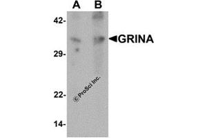Western Blotting (WB) image for anti-Glutamate Receptor, Ionotropic, N-Methyl D-Aspartate-Associated Protein 1 (Glutamate Binding) (GRINA) antibody (ABIN1077413) (GRINA anticorps)