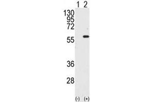 Western blot analysis of STK4 / MST1 antibody and 293 cell lysate either nontransfected (Lane 1) or transiently transfected with the STK4 gene (2). (STK4 anticorps  (AA 385-415))