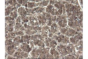 Image no. 9 for anti-Pyridoxamine 5'-Phosphate Oxidase (PNPO) antibody (ABIN1500318)