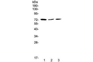 Western blot testing of human 1) HeLa, 2) MCF7 and 3) A375 cell lysate with TORC2 antibody at 0. (CRTC2 anticorps)