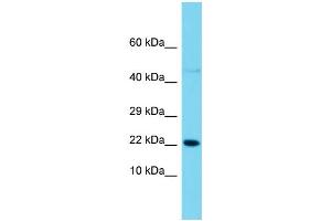 Host: Rabbit  Target Name: Snx12  Sample Tissue: Rat Pancreas lysates  Antibody Dilution: 1. (SNX12 anticorps  (C-Term))