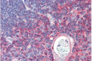 ABIN570663 (5µg/ml) staining of paraffin embedded Human Thymus. (TXK anticorps  (C-Term))
