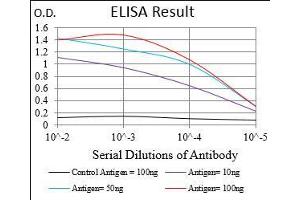 Black line: Control Antigen (100 ng), Purple line: Antigen(10 ng), Blue line: Antigen (50 ng), Red line: Antigen (100 ng), (CD68 anticorps  (AA 42-155))