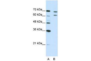 WB Suggested Anti-CPSF3 Antibody Titration:  5. (CPSF3 anticorps  (N-Term))