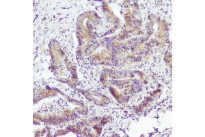 IHC analysis of Caspase-2 using anti-Caspase-2 antibody (ABIN6719550).