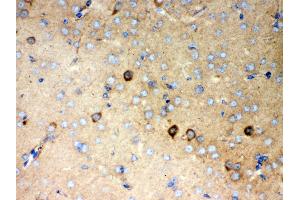 Anti- P2X5 Picoband antibody, IHC(P) IHC(P): Mouse Brain Tissue