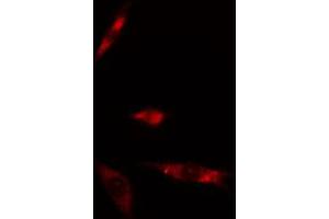 ABIN6274876 staining Hela cells by IF/ICC. (ATPAF2 anticorps)