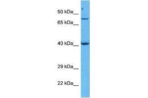 Host:  Rabbit  Target Name:  FOXM1  Sample Tissue:  Human Jurkat Whole Cell  Antibody Dilution:  1ug/ml (FOXM1 anticorps  (Middle Region))