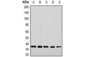 Western blot analysis of Annexin A4 expression in A549 (A), HepG2 (B), mouse liver (C), mouse lung (D), rat kidney (E) whole cell lysates.