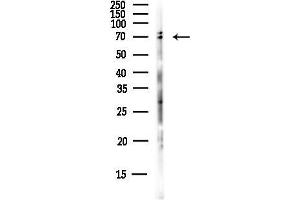 Western blot analysis of lysates from EC304 cells(heat-shock,45 min treatment), using Cytochrome P450 3 Antibody at 1/1000 dilution.