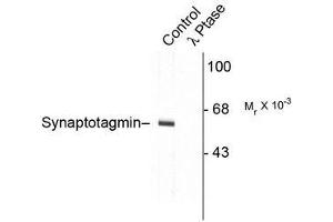 Image no. 1 for anti-Synaptotagmin I (SYT1) (pThr202) antibody (ABIN372724) (SYT1 anticorps  (pThr202))