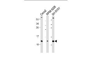 All lanes : Anti-CKS2 Antibody (N-Term) at 1:2000 dilution Lane 1: Caco2 whole cell lysate Lane 2: RI 8226 whole cell lysate Lane 3: SH-SY5Y whole cell lysate Lysates/proteins at 20 μg per lane. (CKS2 anticorps  (AA 6-40))