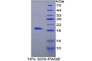 SDS-PAGE analysis of Rat MFAP5 Protein. (MFAP5 Protéine)